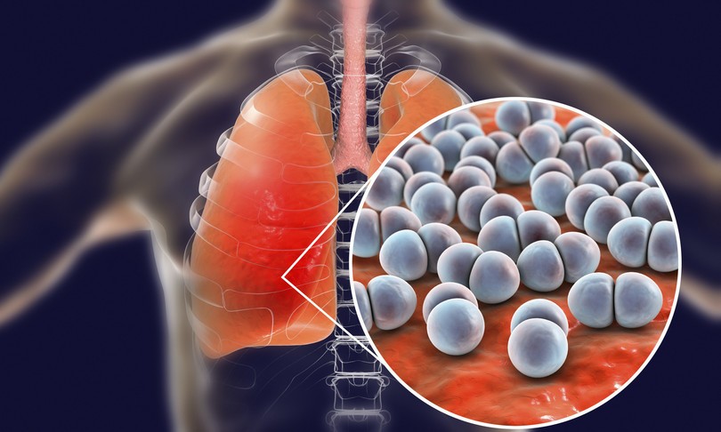 La carenza di vitamina D rende il covid più pericoloso, secondo uno studio