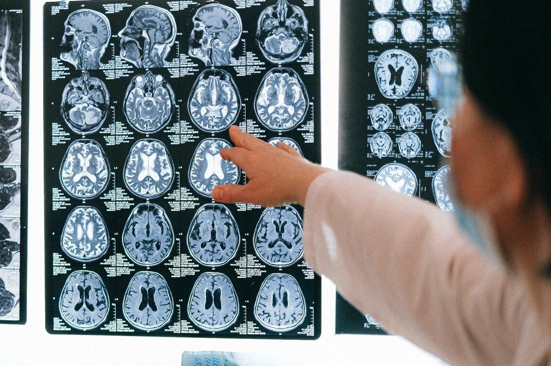 Ragusa, paziente con sospetto tumore aspetta da quasi un mese una tomoscintigrafia cerebrale