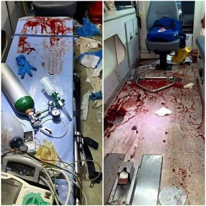 Scoglitti, altra rissa nella notte finita nel sangue, forse per uno sguardo di troppo
