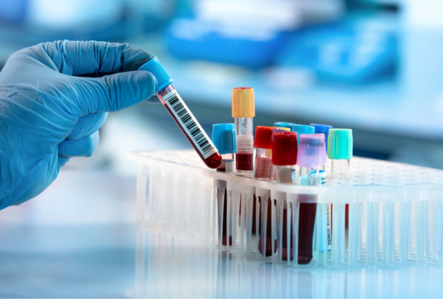 Ragusa, mancano 369mila euro per le prestazioni convenzionate: l’allarme dei Laboratori Siciliani