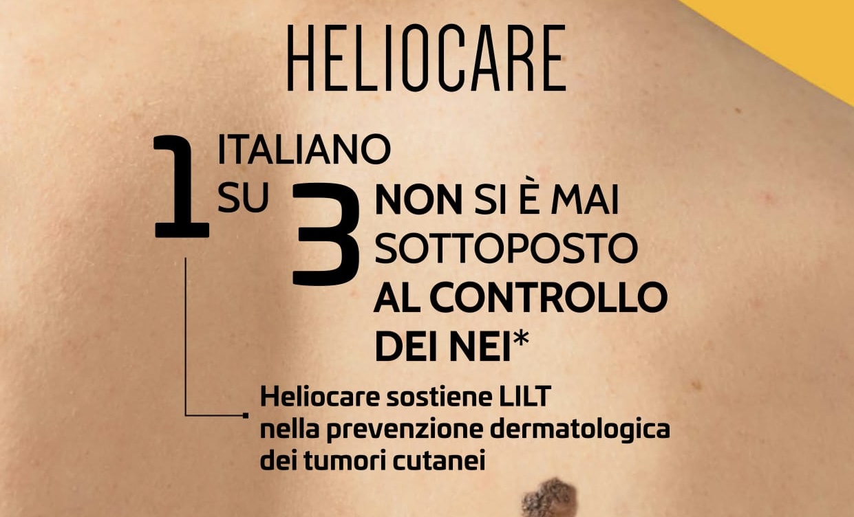 La LiLT di Ragusa aderisce alla campagna nazionale tumori cutanei
